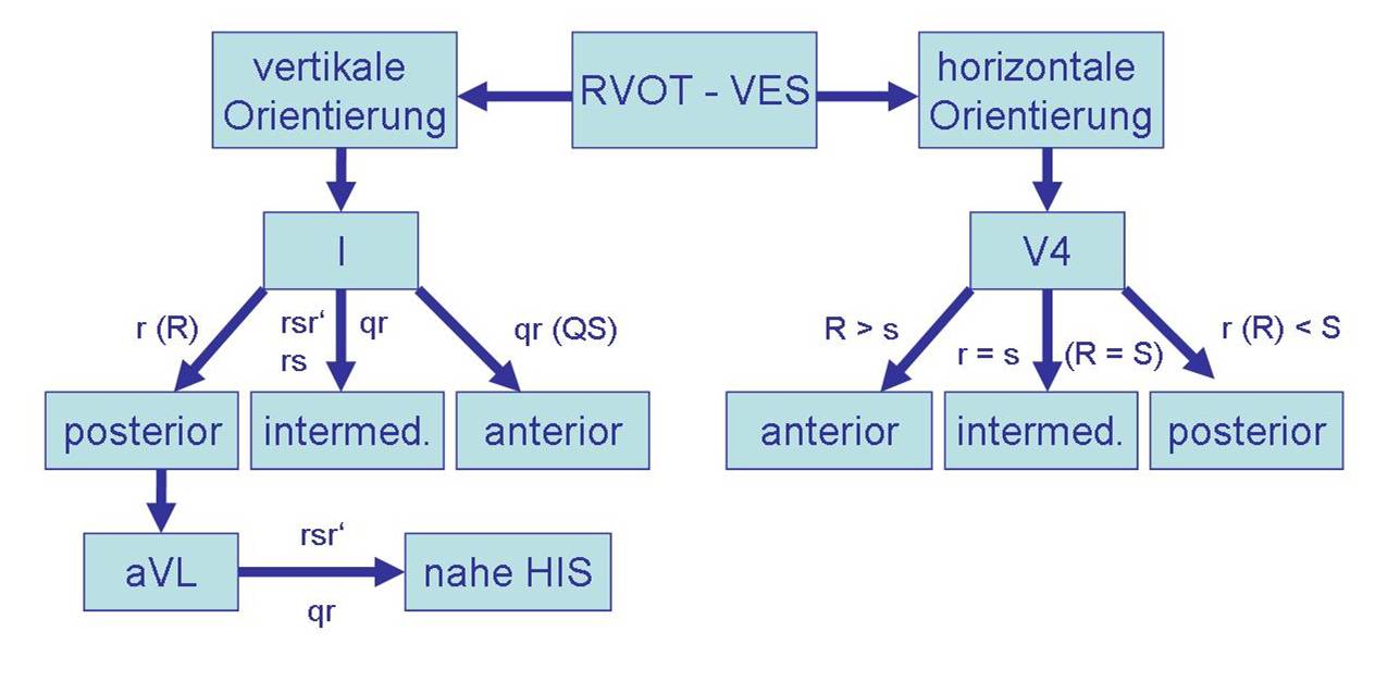 Abbildung 3: Algorithmus zur Differenzierung der horizontalen und vertikalen Orientierung einer ventrikulären Extrasystolie aus dem RVOT = rechtsventrikulärem Ausflußtrakt. Quelle: Benedictus Krankenhaus, Tutzing