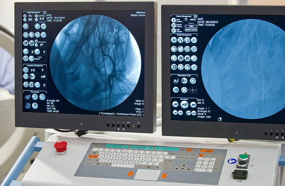 Angiografie Monitore