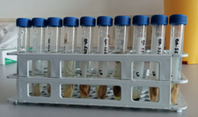 Knochenproben zur Analyse Knochenproben zur Analyse