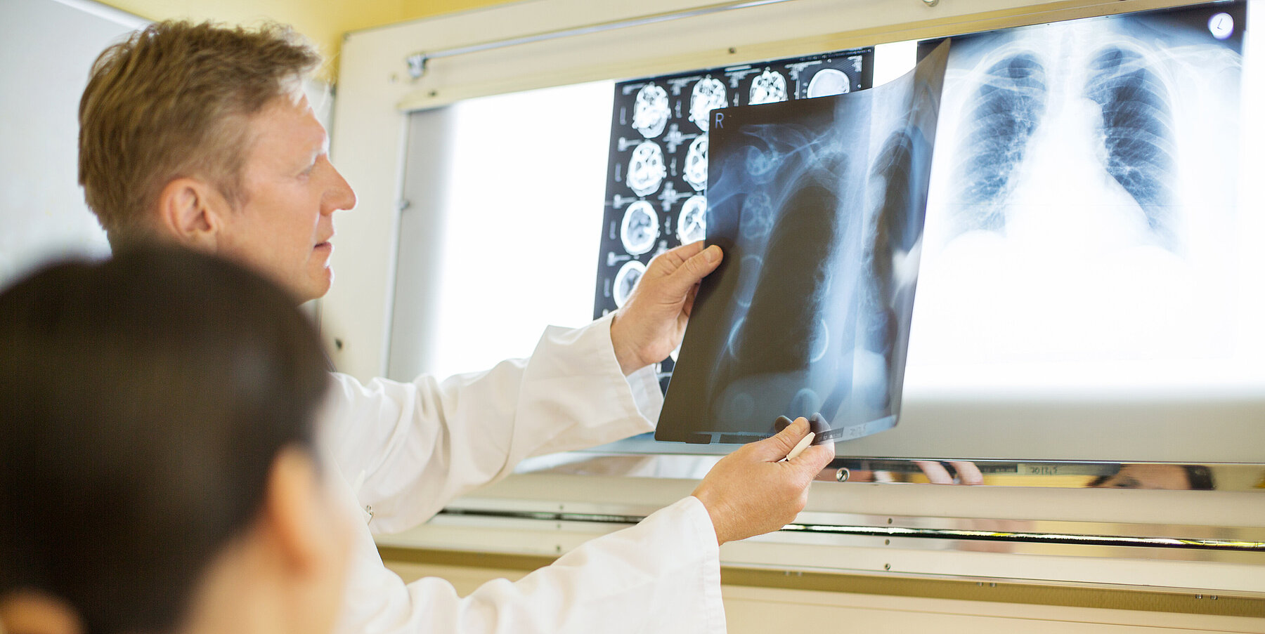 Arzt betrachten Röntgenbilder auf Röntgenschirm