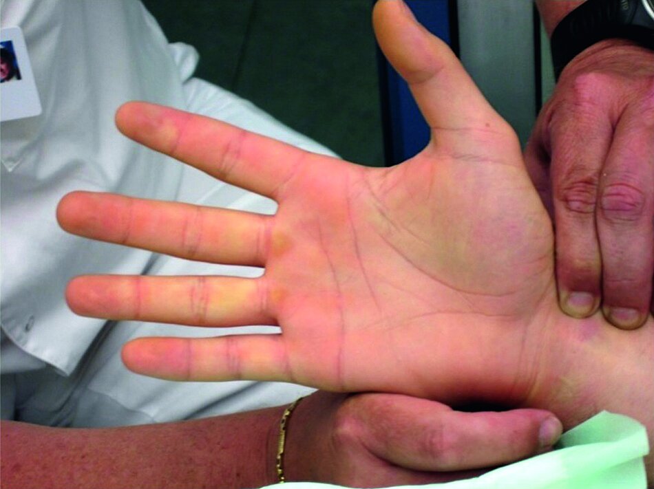 kasuistik-abbildung-hand.jpg