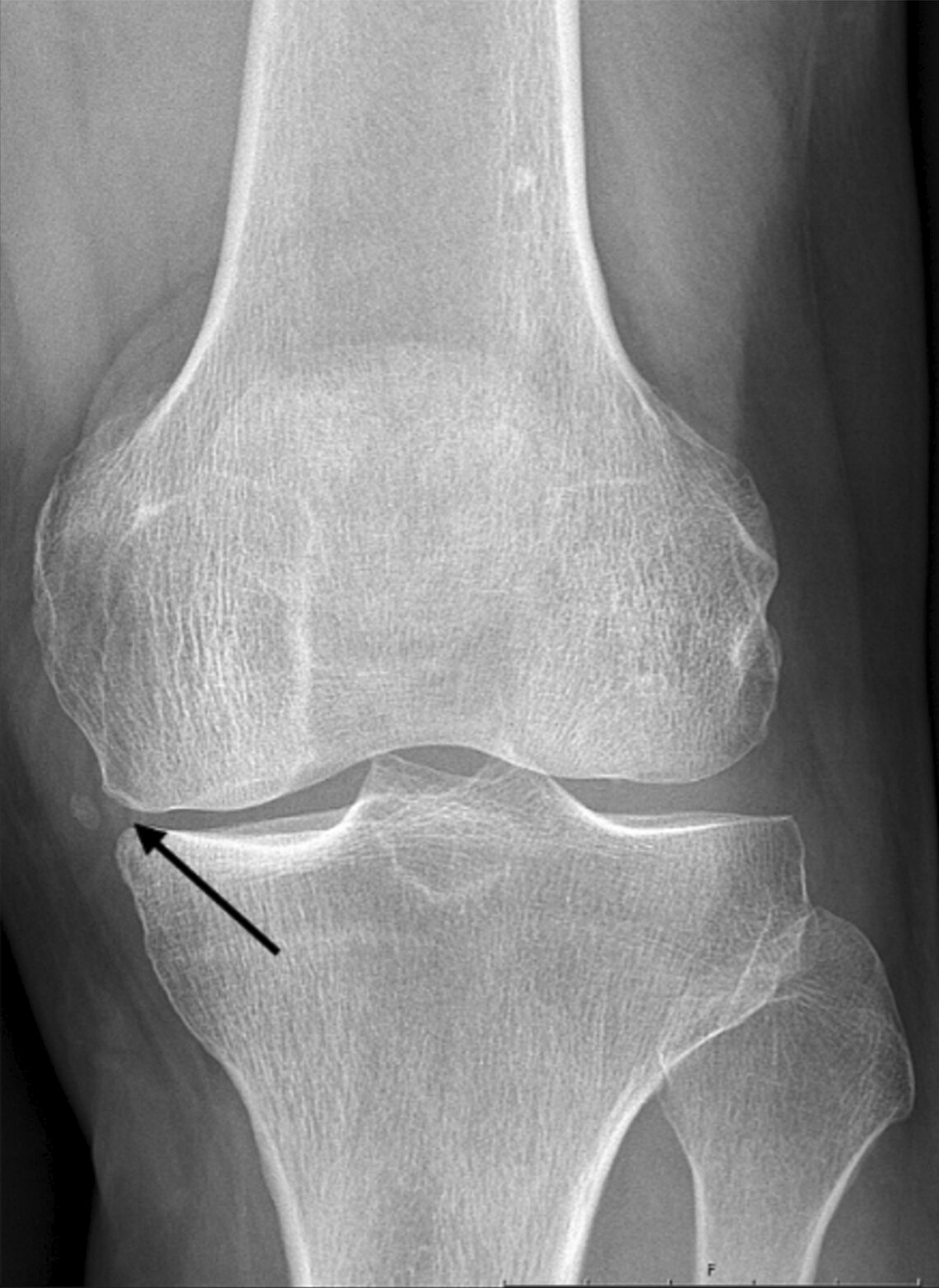 kasuistik-4-2022.jpg linkes Knie