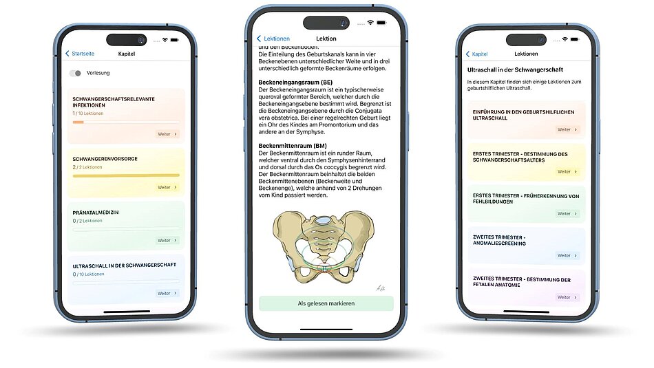 Bild der Lern-App MiLeMed