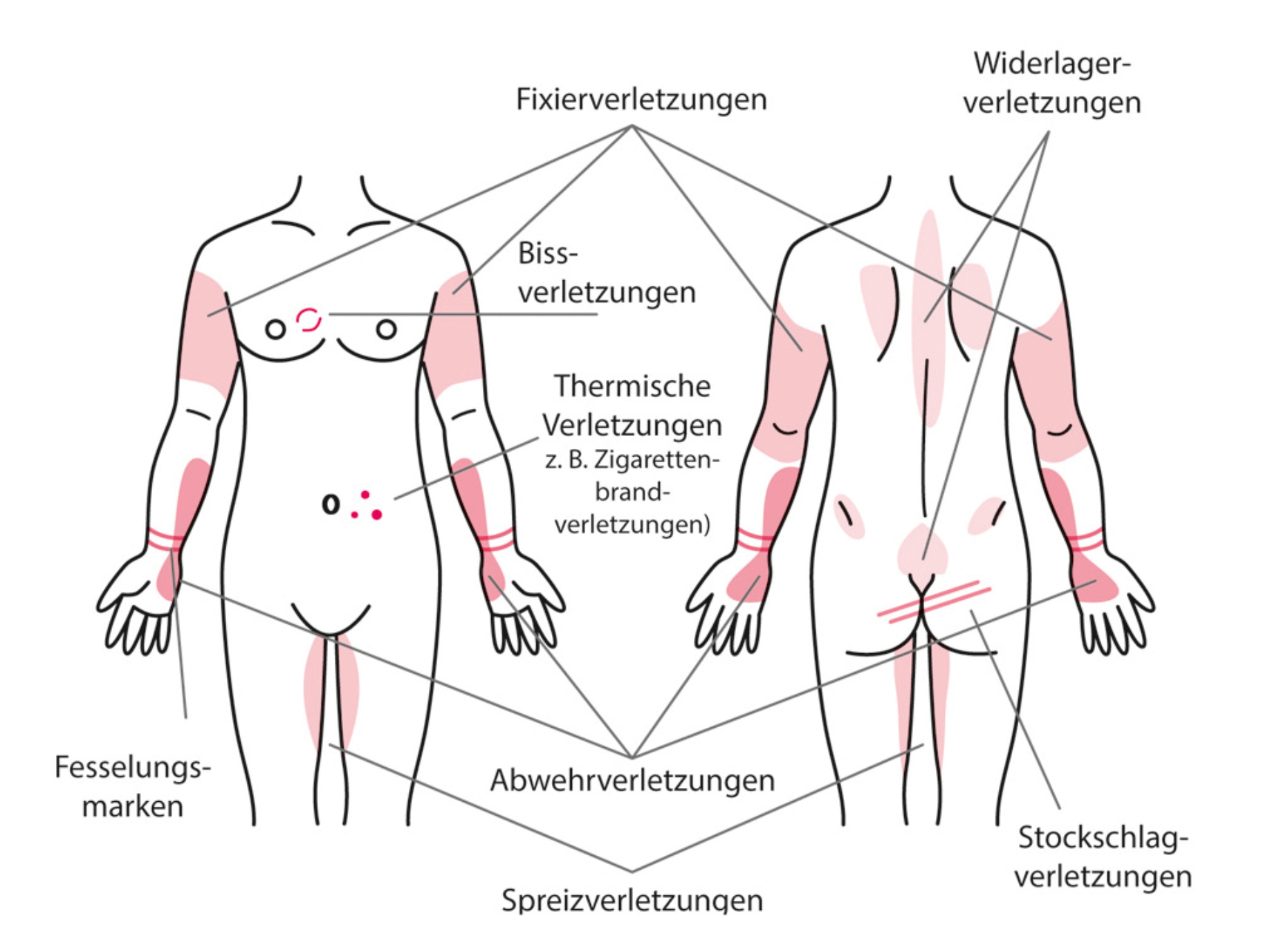 Verletzungen bei sexualisierter Gewalt 