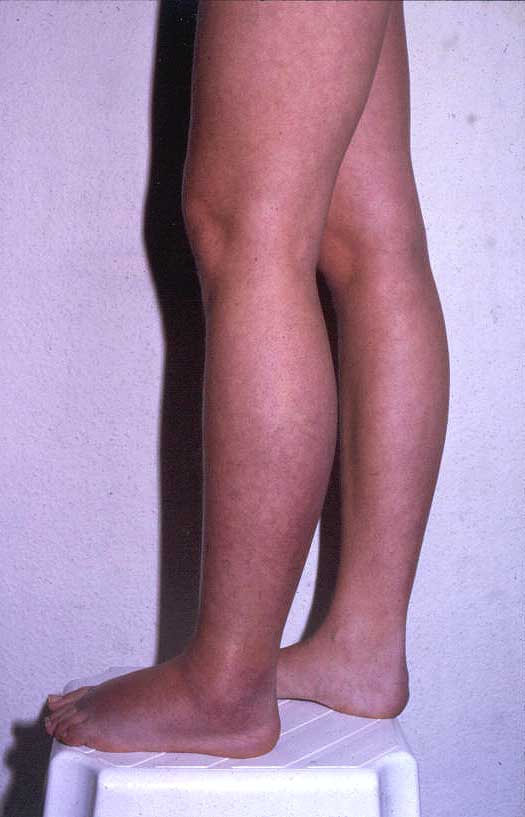 Abbildung 1b Beine