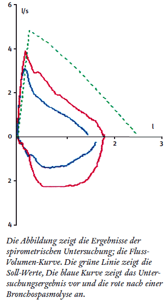 Fluss-Volumen-Diagramm