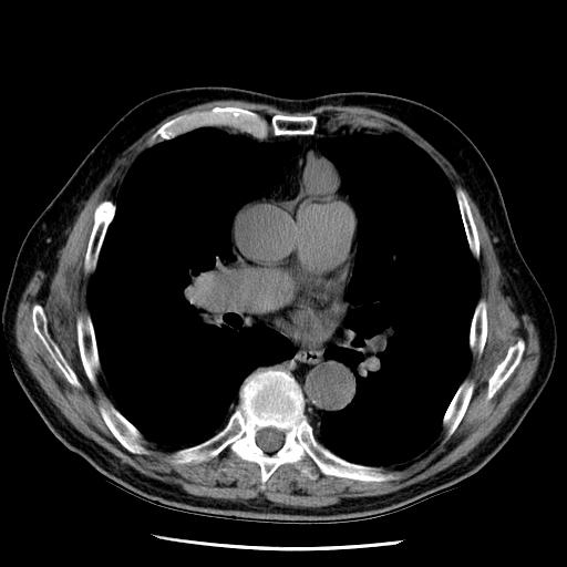 CT-Thorax