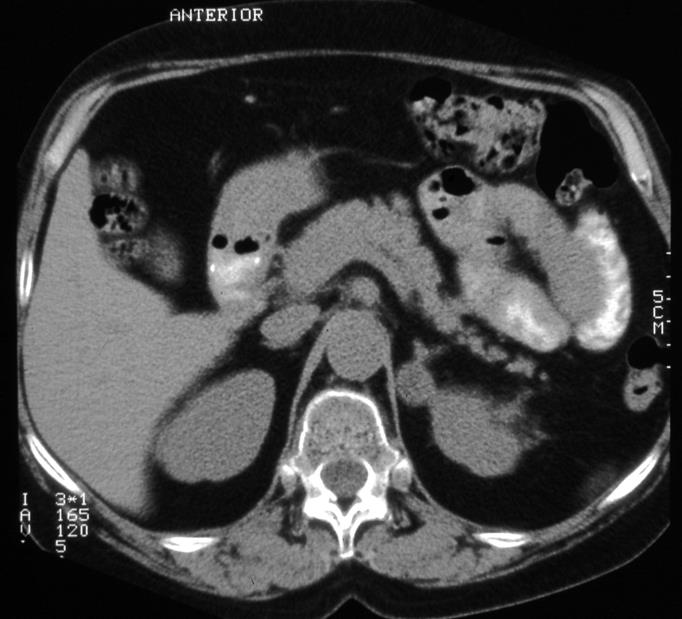 CT-Abdomen