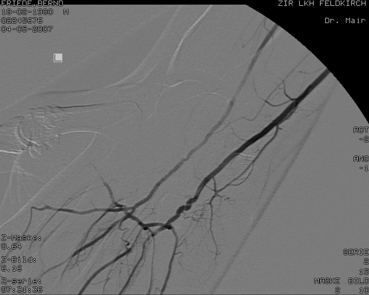 Angiographie